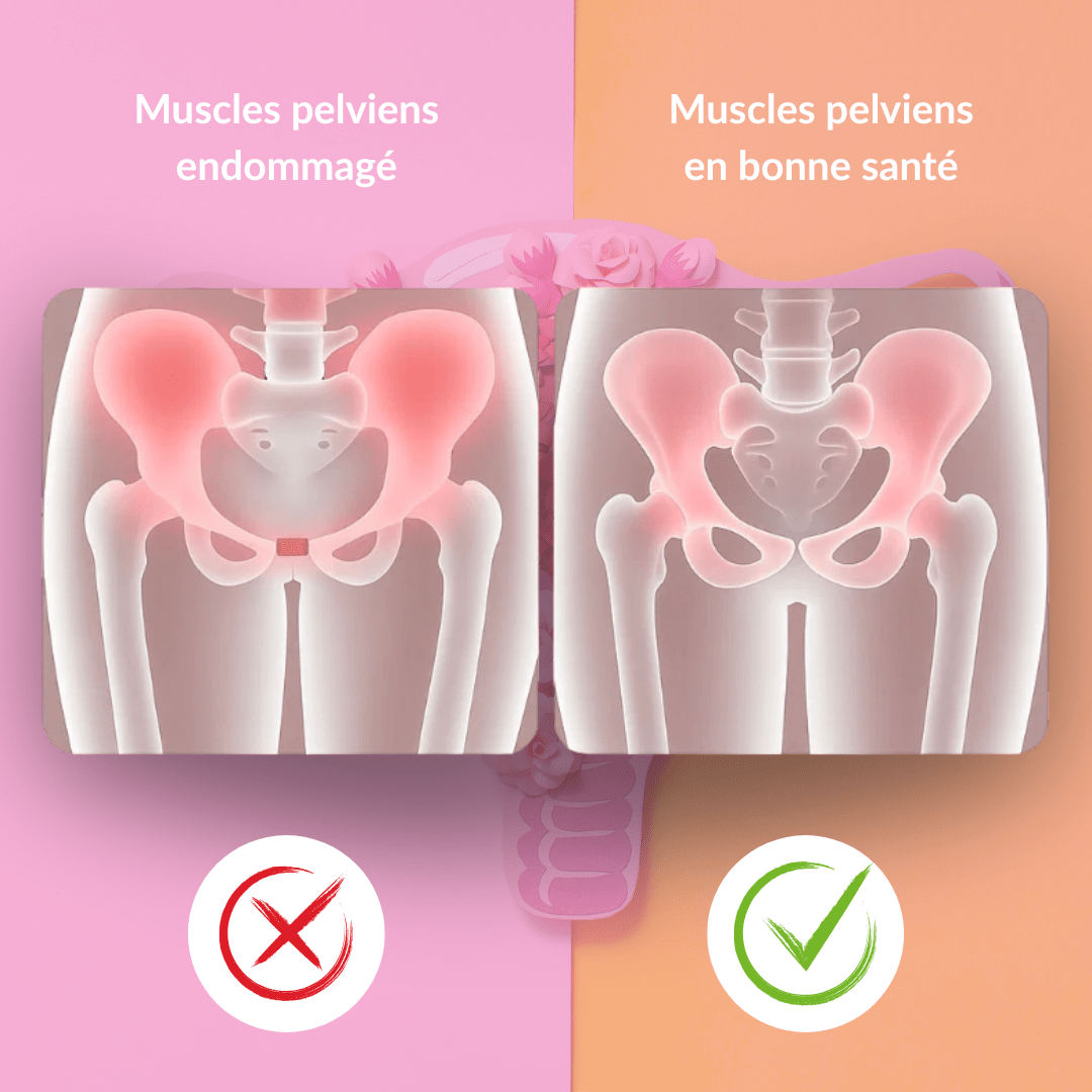 Intima™ la solution pour l’Harmonie Féminine